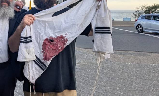 ציצית מוכתמת בדם מהירי.