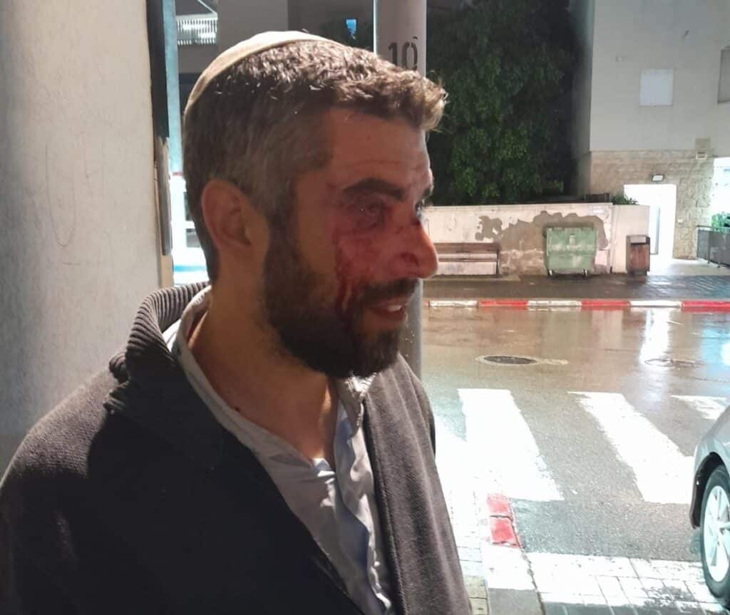 הרב שהותקף. צילום: ללא קרדיט