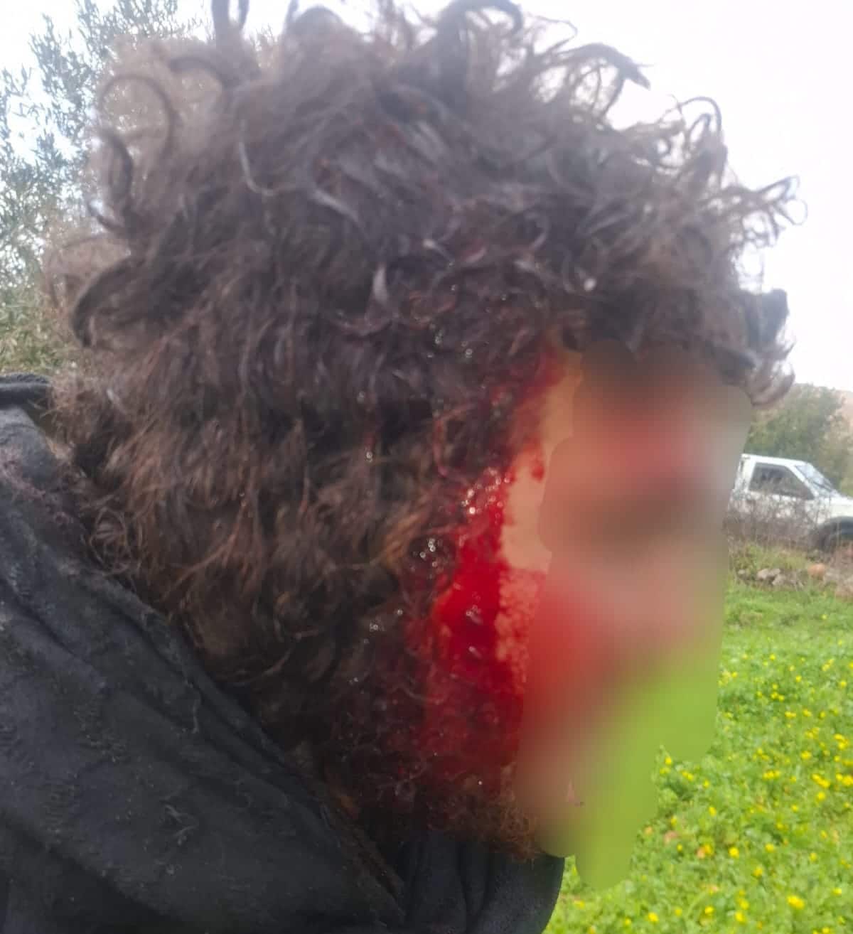 הרועה שנפצע בראשו