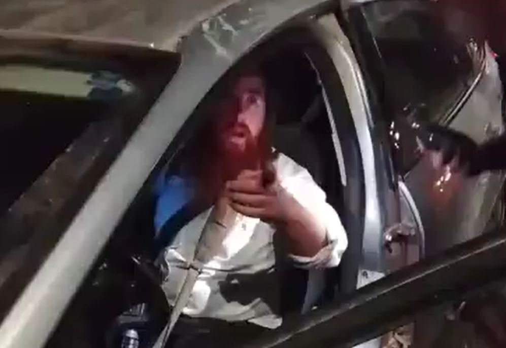 לוחם המילואים שהותקף על ידי שוטרי הרשות הפלסטינית